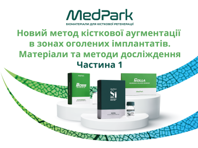 Новий метод кісткової аугментації в зонах оголених імплантатів: клінічна та гістологічна оцінка. Матеріали та методи досліждення 