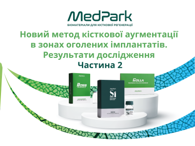 Новий метод кісткової аугментації в зонах оголених імплантатів: клінічна та гістологічна оцінка. Результати дослідження