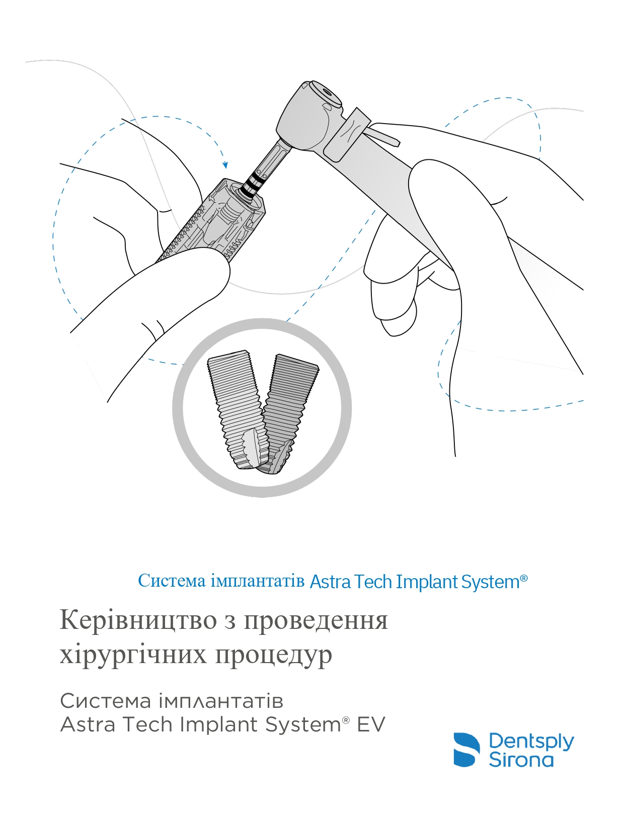 Імплантати Astra Tech Standard